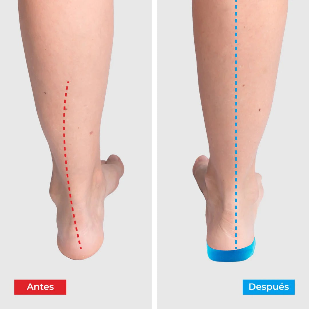 Plantillas Ortopédicas ConfortFeet®  - Disfruta de días sin dolor, sin tratamientos caros ni visitas al médico