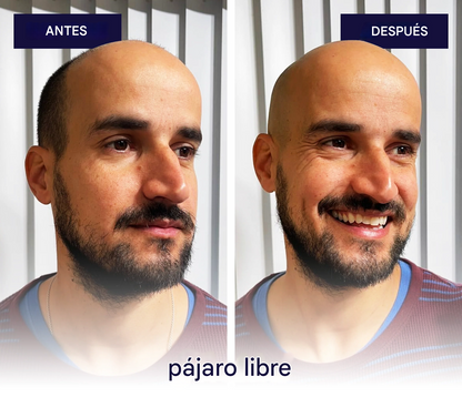 Afeitadora Para Calvos Zero®: Afeitado al ras, sin cortes ni irritaciones