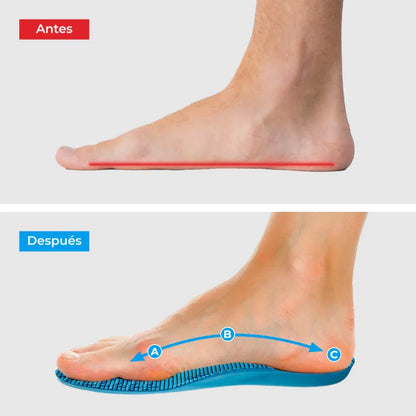 Plantillas Ortopédicas ConfortFeet®  - Disfruta de días sin dolor, sin tratamientos caros ni visitas al médico