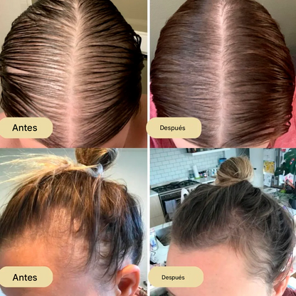 Veganic® Aceite natural para el crecimiento del cabello