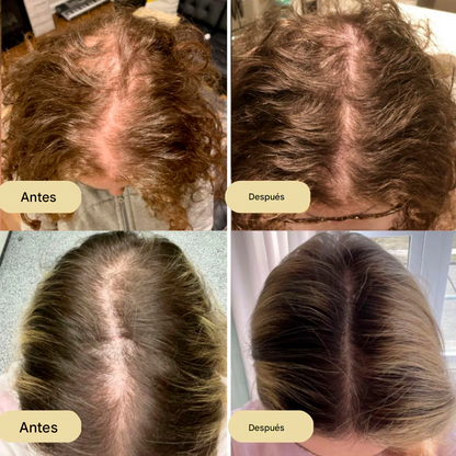 Veganic® Aceite natural para el crecimiento del cabello