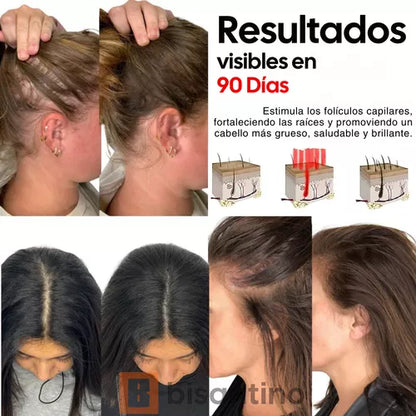 CEPILLO DE FOTOTERAPIA CAPILAR CON VAPORIZACIÓN Y MASAJEADOR + ENVÍO GRATIS! 🎁